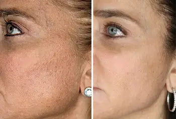 Before and After