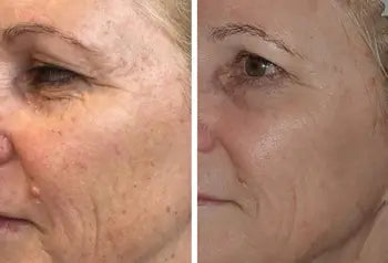 Before and After